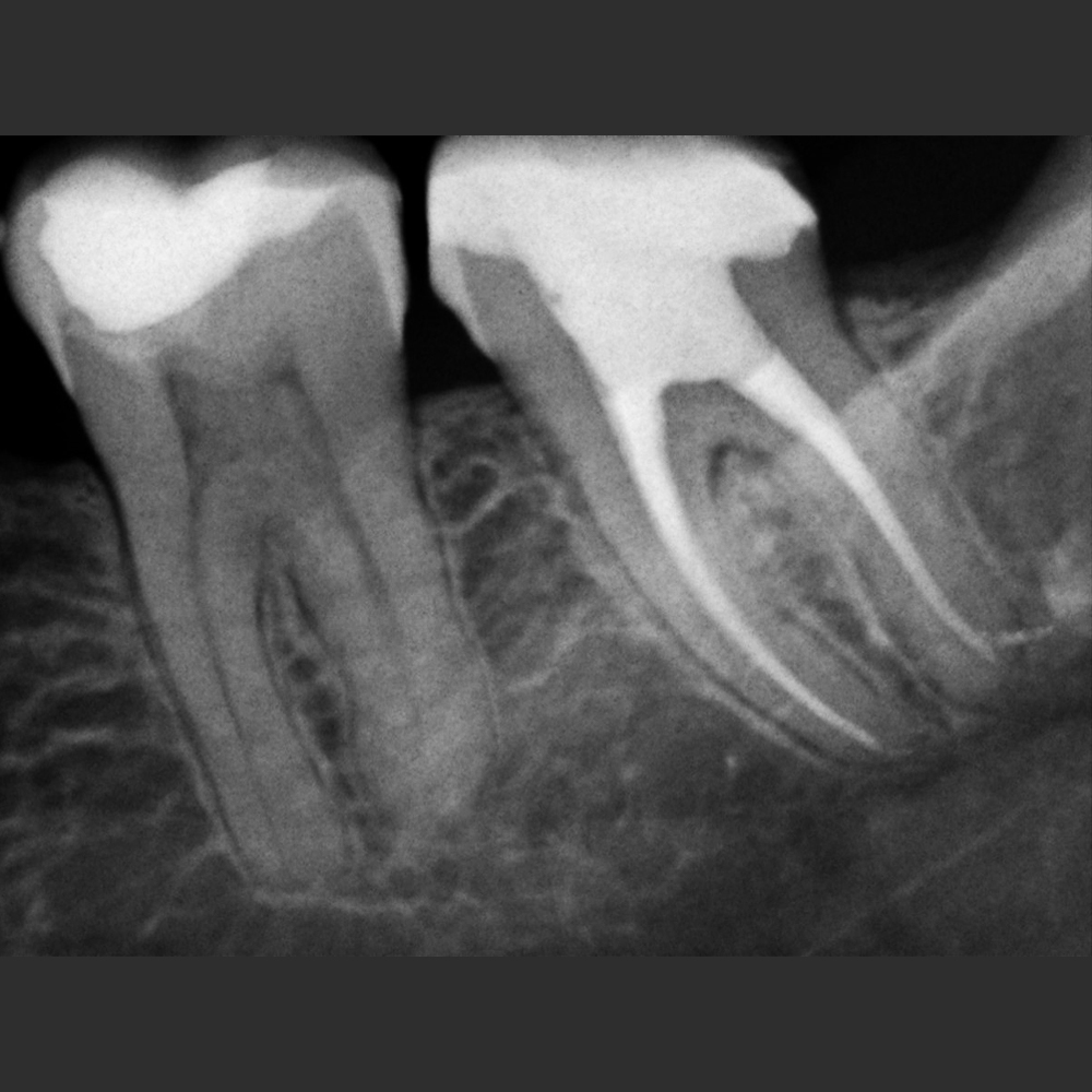NEWTOM X-VS E Sensor - Image 2
