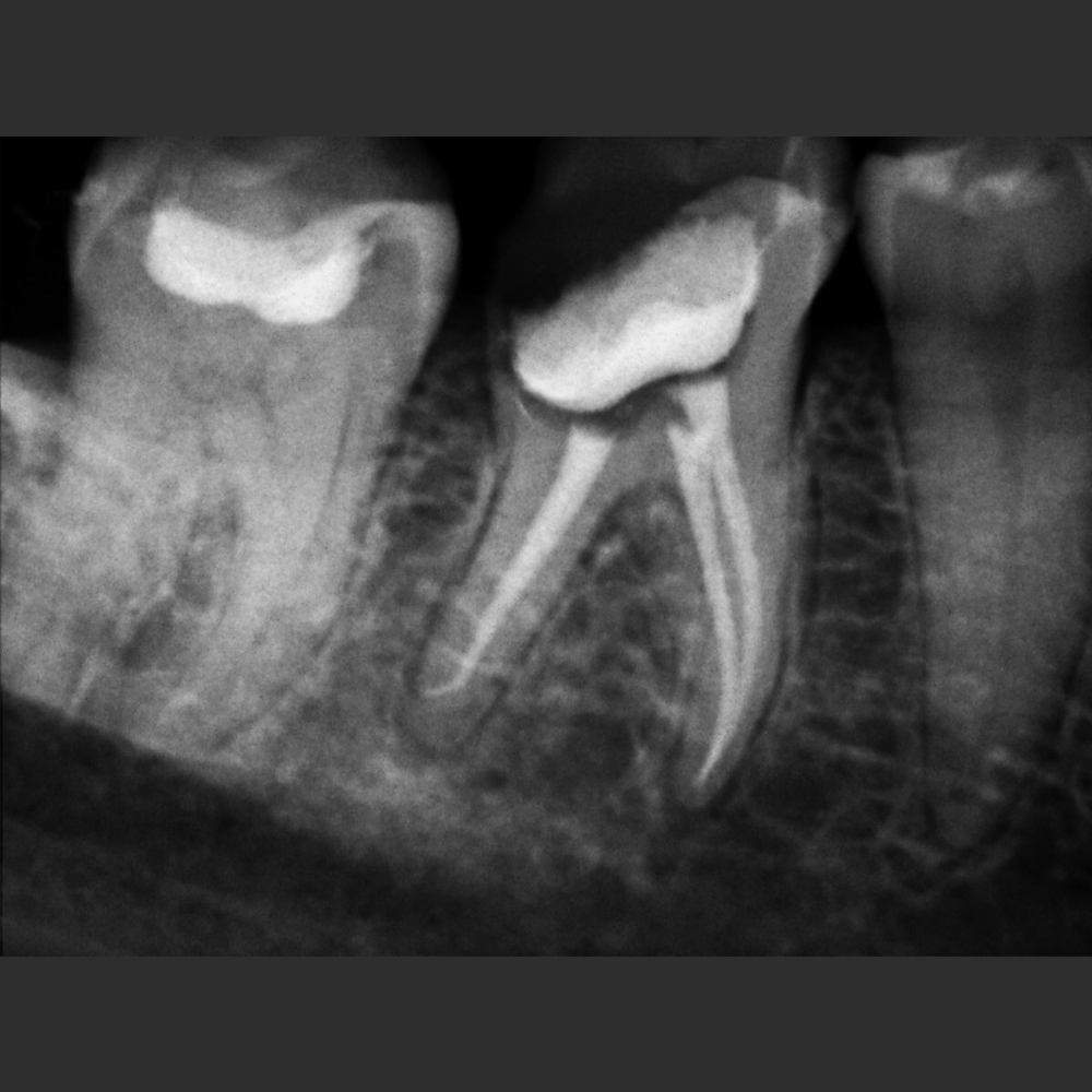 NEWTOM X-VS E Sensor - Image 3