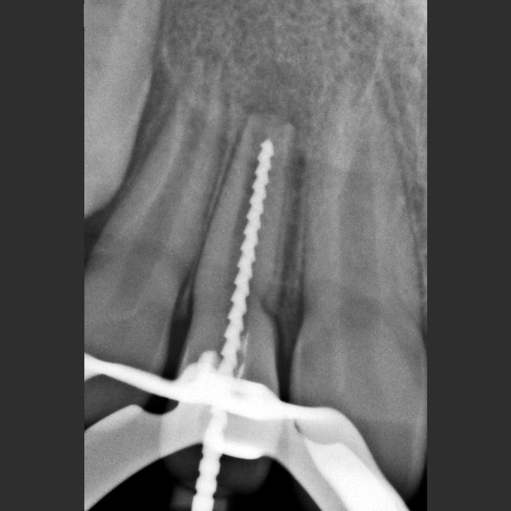 NEWTOM X-VS E Sensor - Image 4