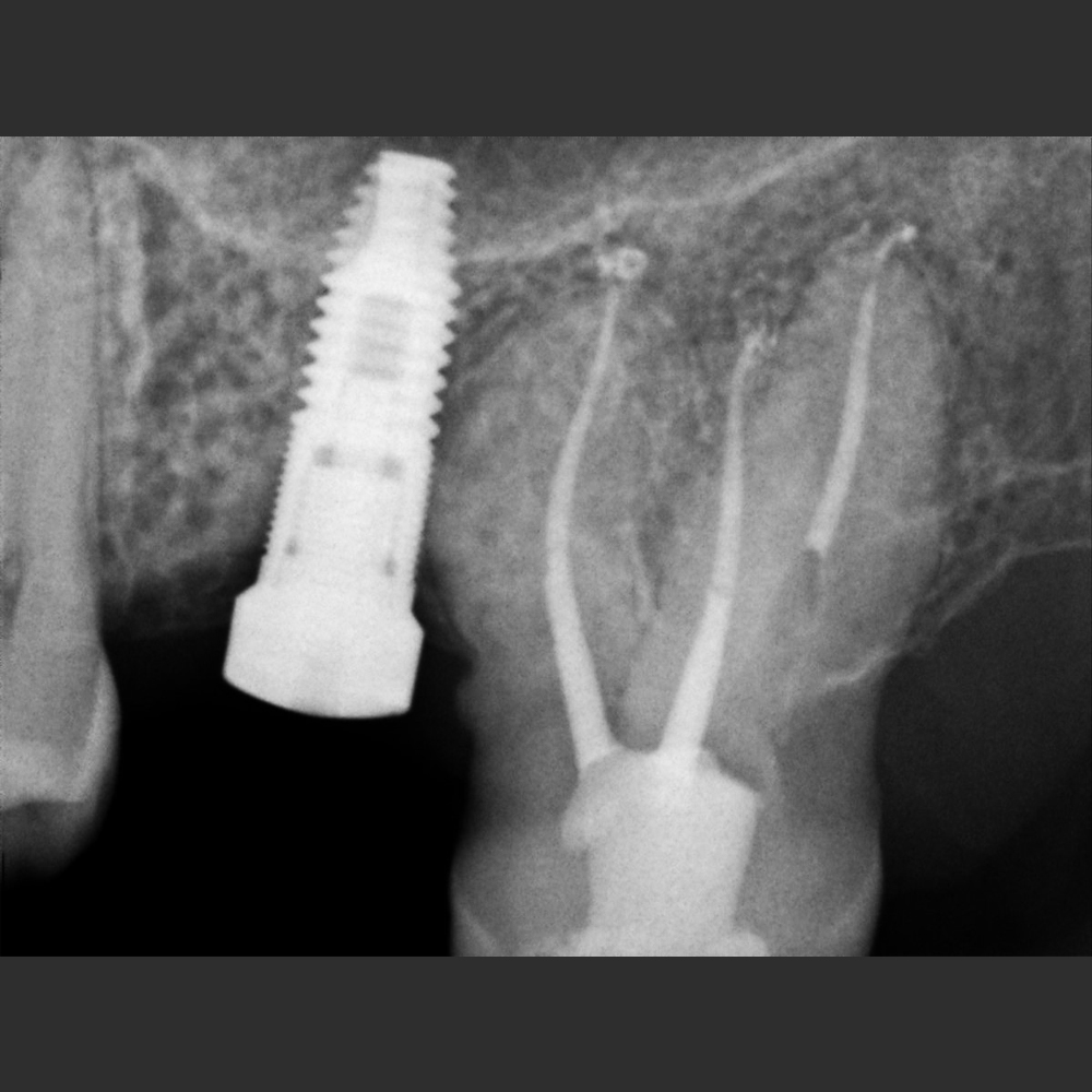 NEWTOM X-VS E Sensor - Image 5